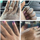 Dry Skin Therapy - Fragrance of Elegance
